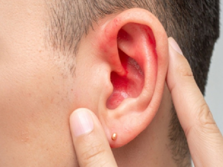 अदरक और सेंधा नमक से बना तेल कानों के दर्द से आराम दिलाने में है प्रभावी, जान लें प्रयोग से पहले की सावधानी