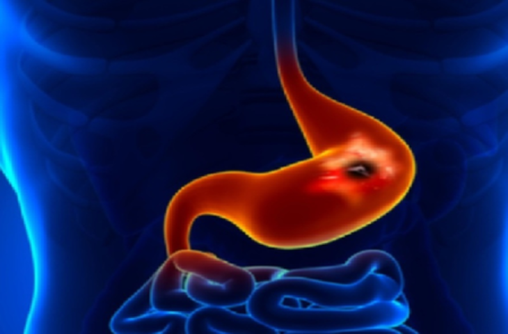 'लाइफ कंट्रोल सेंटर' है पैंक्रियास, अनदेखा करना होगा सेहत के साथ खिलवाड़