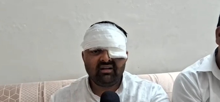 दिग्विजय भाटी ने कहा-मेरठ एसएसपी और सिविल लाइन इंस्पेक्टर ने किया थर्ड-डिग्री टॉर्चर, एक आंख फोड़ने का आरोप