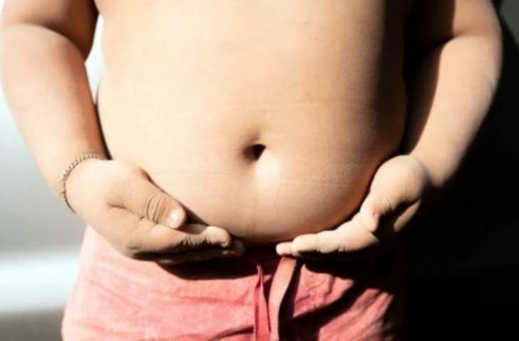 मात्र 39 वर्ष हो सकती है बचपन में गंभीर मोटापे से ग्रस्त हो चुके लोगों की जीवन प्रत्याशा : शोध