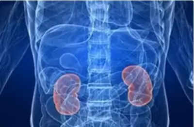किडनी स्टोन में अचानक बढ़ोतरी! क्या बदल गई है हमारी डाइट?