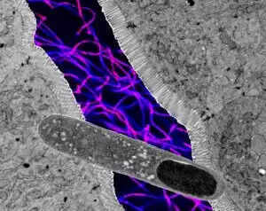 अमेरिकी वैज्ञानिकों ने ढूंढ निकाला ऐसा गट बैक्टीरिया जो वजन कम करने में भी मददगार