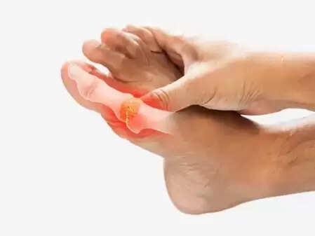 'आम' है गठिया की मुख्य वजह, आयुर्वेद से जानें बचाव का तरीका