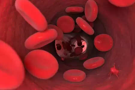 गर्भावस्था में हीमोग्लोबिन की कमी मां और बच्चे दोनों के लिए खतरनाक, इन उपायों से रहें सुरक्षित