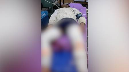 तिलक नगर मुस्कान हत्याकांड : आरोपी जिम ट्रेनर इमरान मुठभेड़ के बाद गिरफ्तार