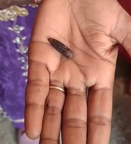 हरियाणा: 12 साल की बच्ची को लगी थी एसएलआर की गोली, 32 साल की उम्र में चला पता