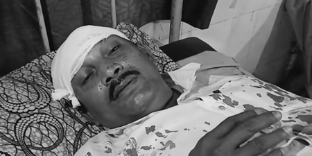 टीएमसी के बदमाशों ने मेरे सिर पर रॉड से वार किया : भाजपा पोलिंग एजेंट