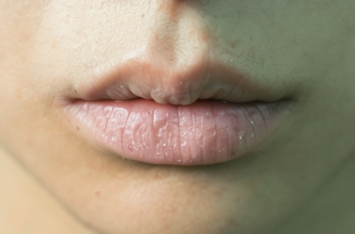 सर्दियों में भी रखें होंठों की नमी बरकरार, अपनाएं घरेलू और सुरक्षित उपाय