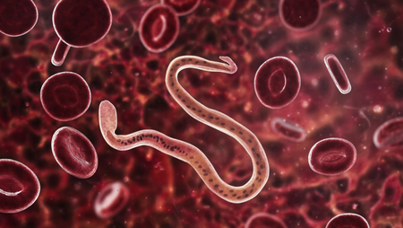 बार-बार गैस बनना हो सकता है खतरे का संकेत, इंटेस्टाइनल वर्म इन्फेक्शन को न करें नजरअंदाज