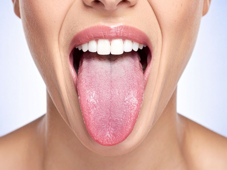 हल्के में न ले सफेद जीभ की परेशानी, देती है शरीर की आंतरिक बीमारियों का संकेत