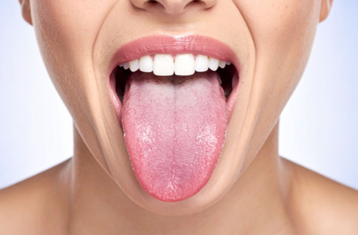 हल्के में न ले सफेद जीभ की परेशानी, देती है शरीर की आंतरिक बीमारियों का संकेत