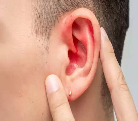 सर्दियों में कानों की देखभाल करना जरूरी क्यों है? पूरे शरीर से जुड़ा है कनेक्शन