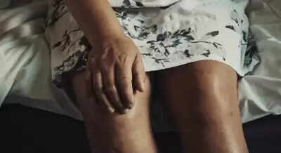 सर्दियों में बढ़ गई है गठिया की समस्या? इन उपायों से मिलेगी राहत