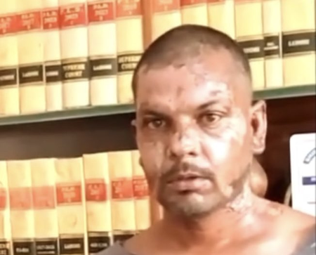 पाकिस्तान में ईसाई व्यक्ति पर बर्बर हमला, अधिकार समूह ने की कड़ी निंदा