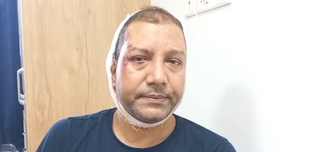 मुझे घेरा गया और हमला किया, उनके पास लाठियां और पत्थर थे : इंस्पेक्टर नंद किशोर सिंह
