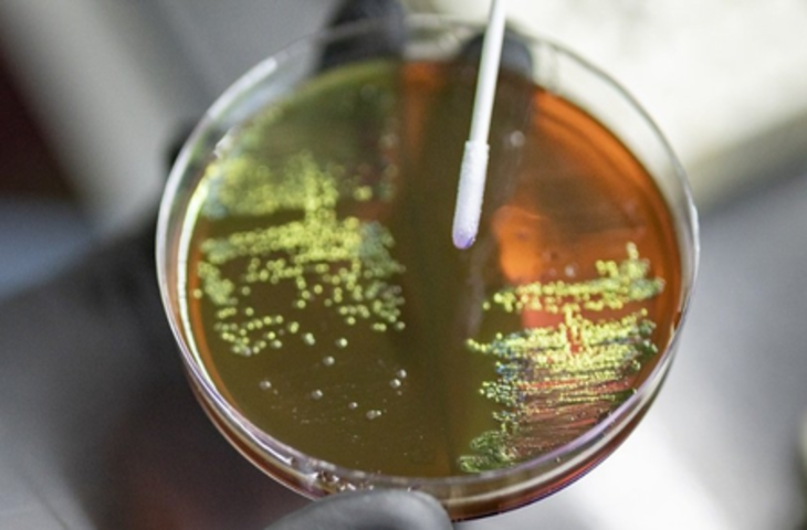 एएमआर भविष्य ही नहीं, वर्तमान के लिए भी खतरनाक: विशेषज्ञ