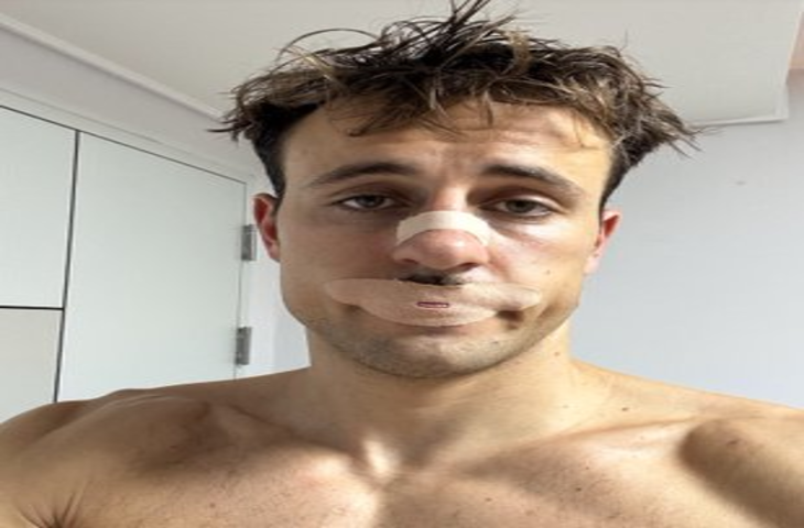 सोते समय मुंह पर टेप लगाने का सोशल मीडिया का चलन गंभीर खतरा पैदा कर सकता है : अध्ययन