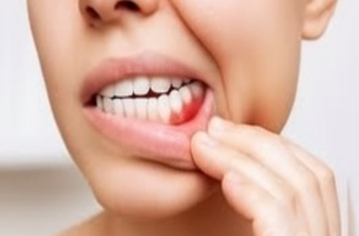 दांतों में तेज झनझनाहट और दर्द, इन घरेलू नुस्खों से मिलेगा छुटकारा