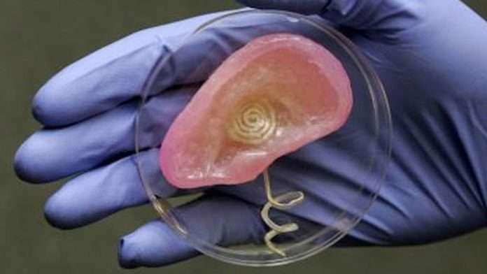 भारतीय डॉक्टर्स ने बनाया कृत्रिम कान, मेडिकल में नया अविष्कार