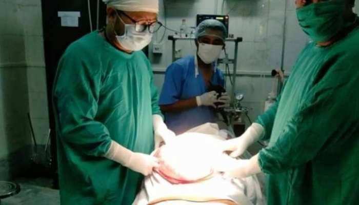 uttar pradesh के अस्पताल में मरीज के पेट से निकाला गया 24 किलो का ट्यूमर