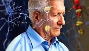 इन दो प्रमुख कारणों की वजह से होता है अल्जाइमर, उम्र के इस विशेष पड़ाव में दिखता है असर