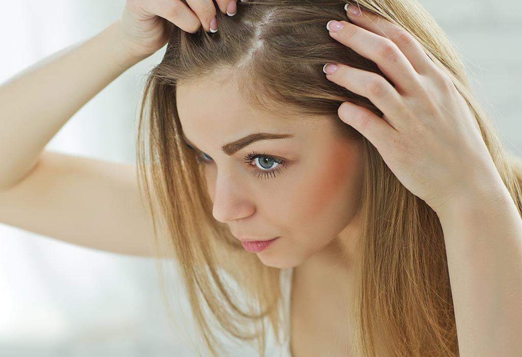 Hair Problem: सिर में जूं? इन सभी समस्याओं में बालों का झड़ना देखा जा सकता है