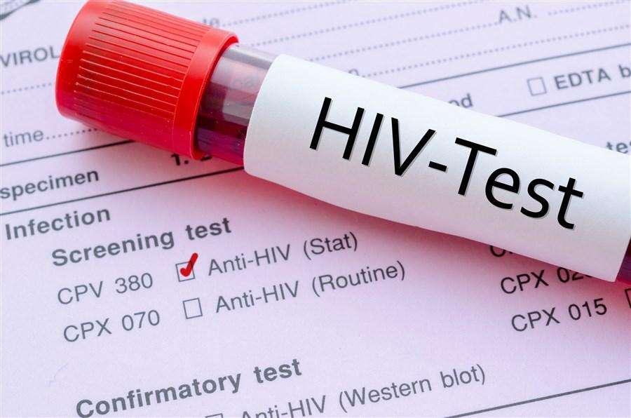 एड्स – जानिए कब, कहां और कैसे अस्तित्व में आई यह बीमारी