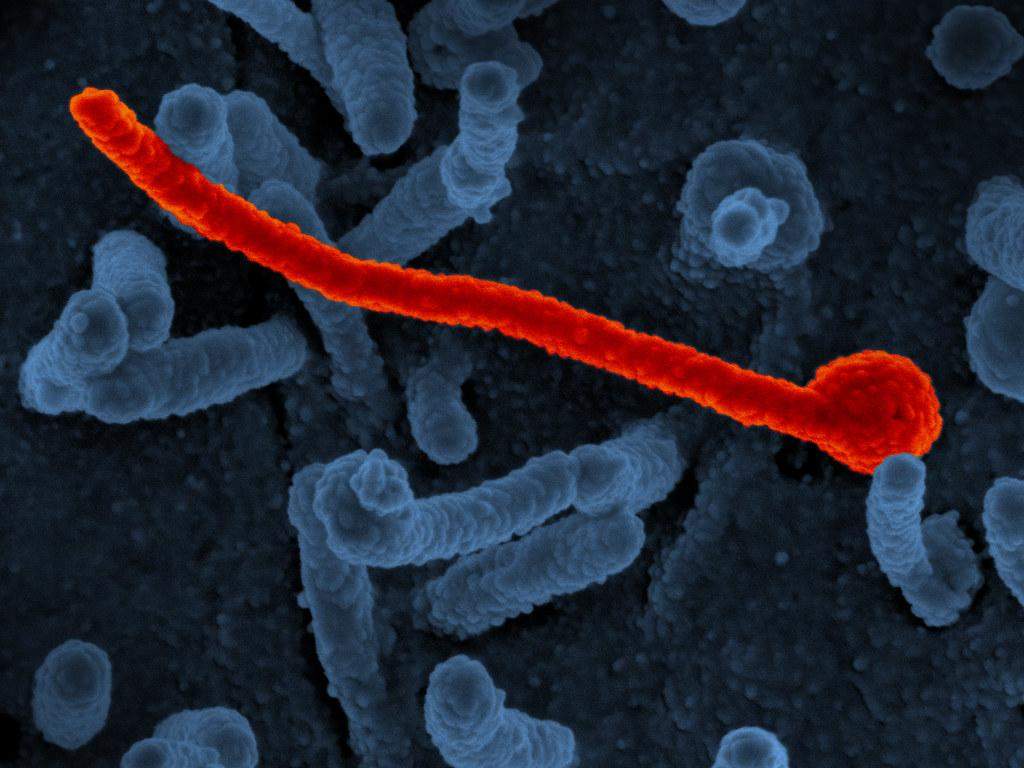 WHO ने  किया घोषित इबोला है भारी संकट  इमरजेंसी अलर्ट जारी