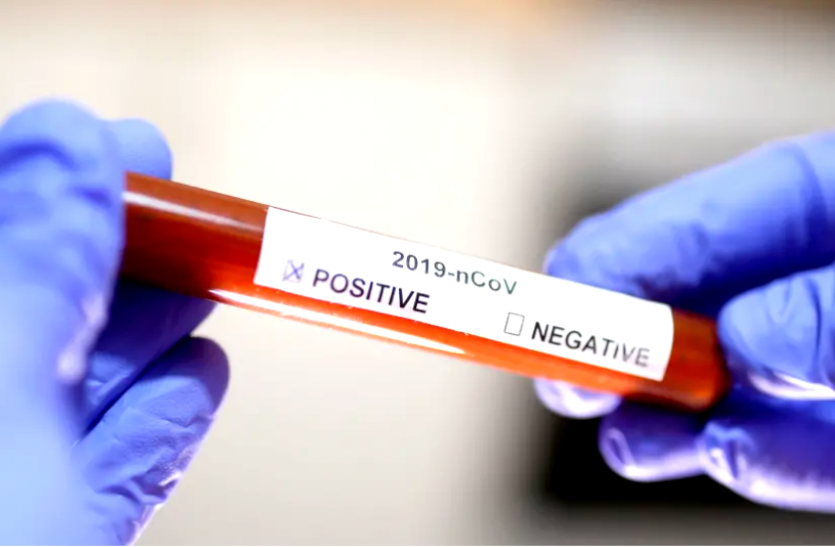 Study: रक्त परीक्षण गंभीर कोविद -19 के शुरुआती संकेतक की पेशकश कर सकते हैं?