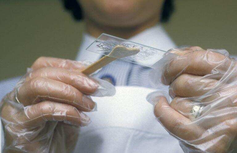 जानें क्या होता है पैप स्मीयर टेस्ट और किस लिए किया जाता है यह टेस्ट