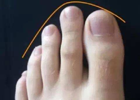 99% लोग नहीं जानते हैं पैर की दूसरी ऊँगली के बड़े होने का असली मतलब, एक बार जरूर पढ़ लें