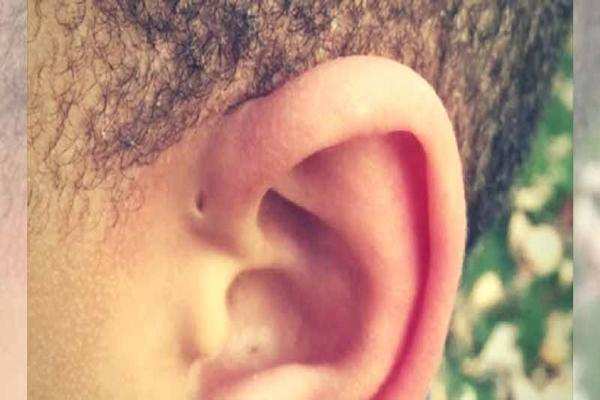 क्या आपके कान में कोई छेद हैं, जो आपने कभी नहीं देखा