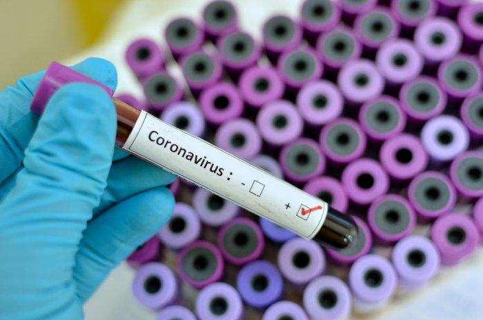 विश्व में बढ़ता कोरोना महामारी का खतरा, शोधकर्ताओं ने किया कोरोना के नए लक्षण का खुलासा