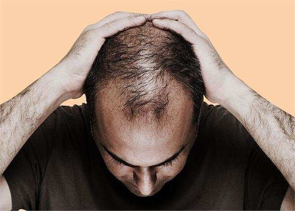 शनि ग्रह के प्रभाव से सिर से कम होते हैं बाल