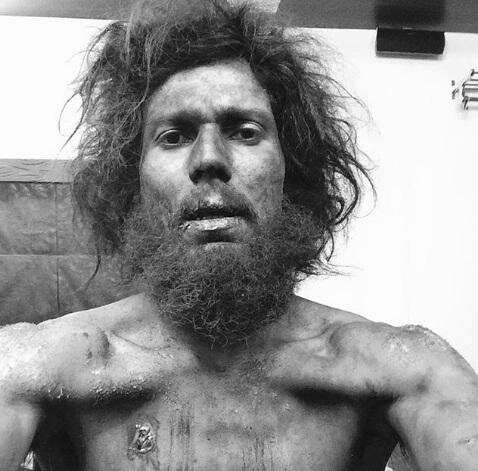 randeep hooda hospitalized: रणदीप हुड्डा के ​चाहने वालों के लिए आई बुरी खबर, अस्पताल में भर्ती हुए अभिनेता