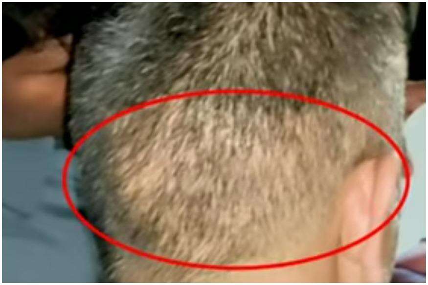 टीम इंडिया से दूर एमएस धोनी ने कराया हेयर ट्रांस प्लांट