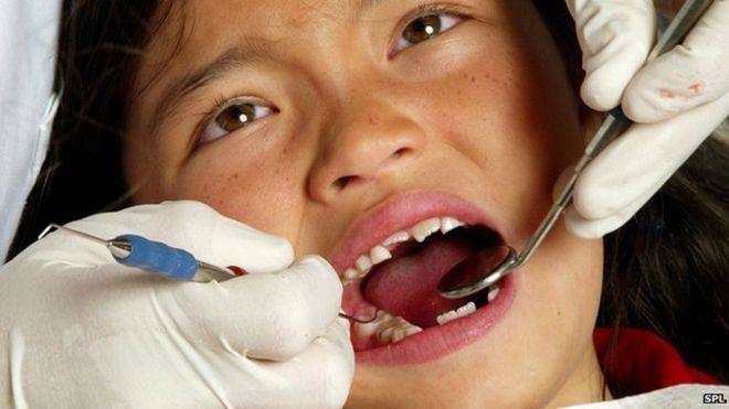 दाँत सड़ने की नहीं है वजह सिर्फ खाना बल्कि इन कारणों से भी सड़ सकते हैं 