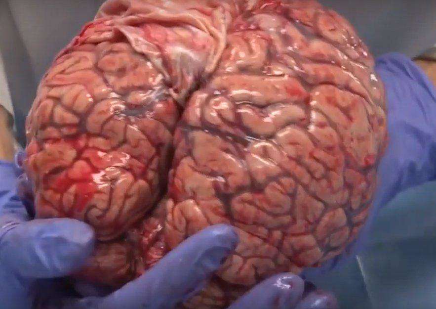 शरीर में फिट किया हुआ ये उपकरण आपके दिमाग को करेगा नियंत्रण