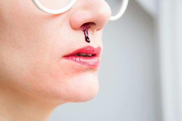 Hemorrhage problem:नाक से खून आने की समस्या से बचने के लिए, आप करें इन घरेलू उपायों से उपचार