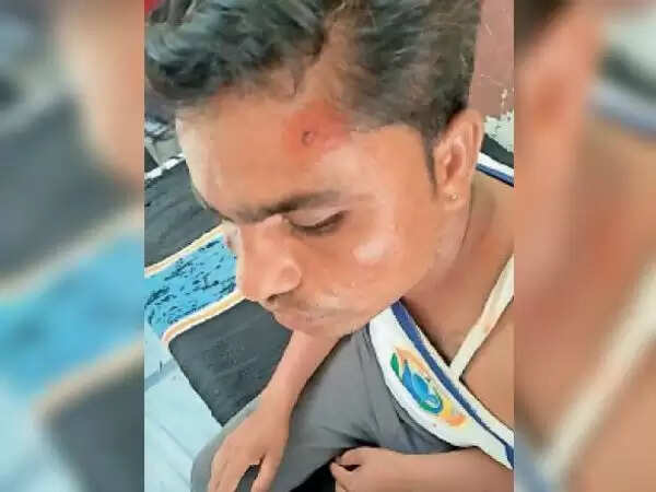 भीलवाड़ा : नांदसा जागीर की घटना:घर के अागे नाली नहीं बनाने की कहते हुए सरपंच पति पर हमला