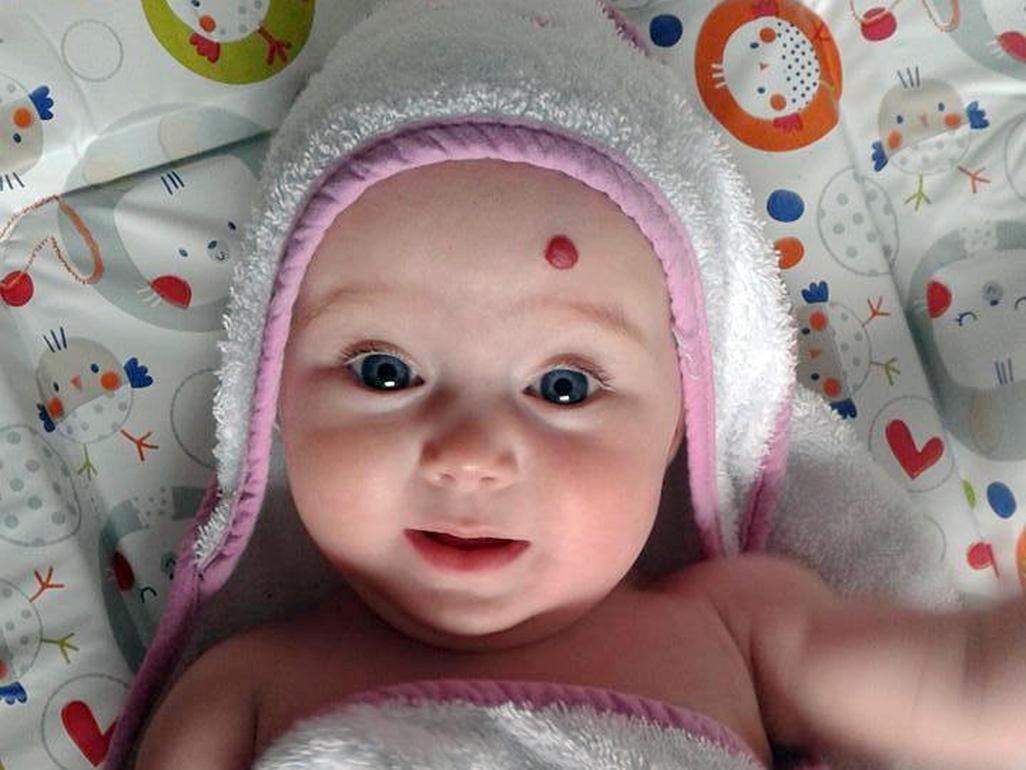 2 माह के बच्चे के पेट से निकला भ्रूण जानिए क्या है इसके पीछे की कहानी