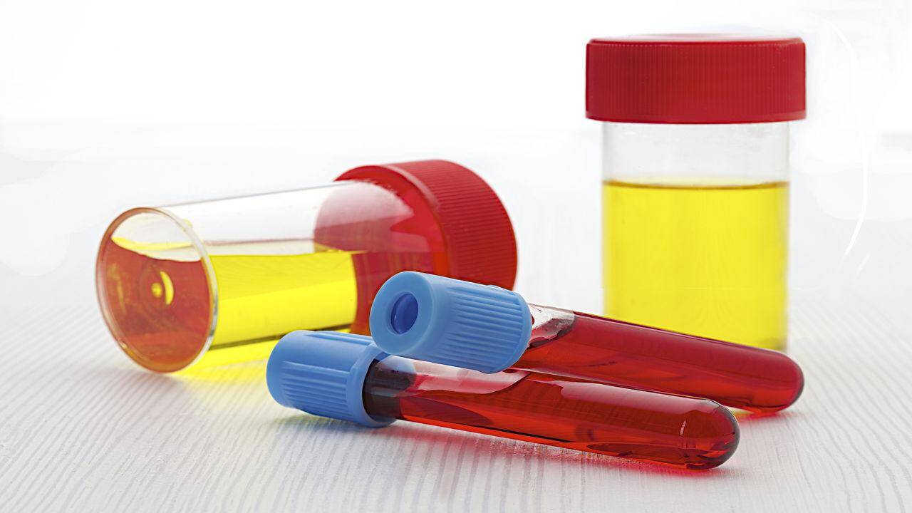 अगर आता है पैशाब में खून तो हो सकती है ये समस्या