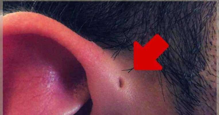 आपके कान में कोई छेद तो समझ लिजिये कि आपके शरीर का पुरी विकास नहीं हुआ है
