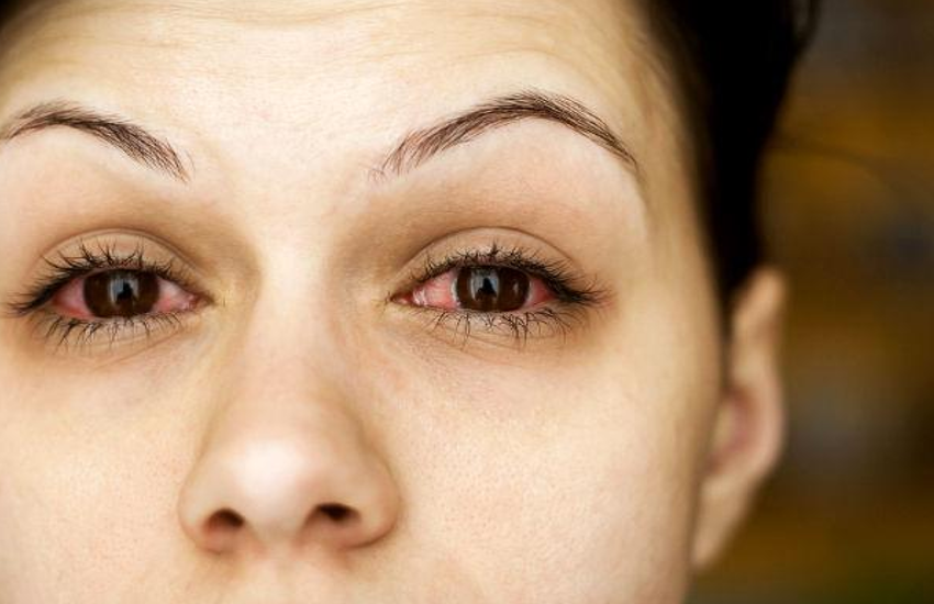 Health tips:आंखों में संक्रमण से बढ़ता कोरोना का खतरा, इन उपायों से रखें आंखों को स्वस्थ