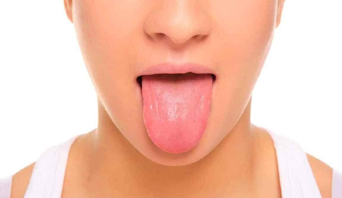 जीभ का सफेद होना भी हो सकता का कई बीमारियों के संकेत