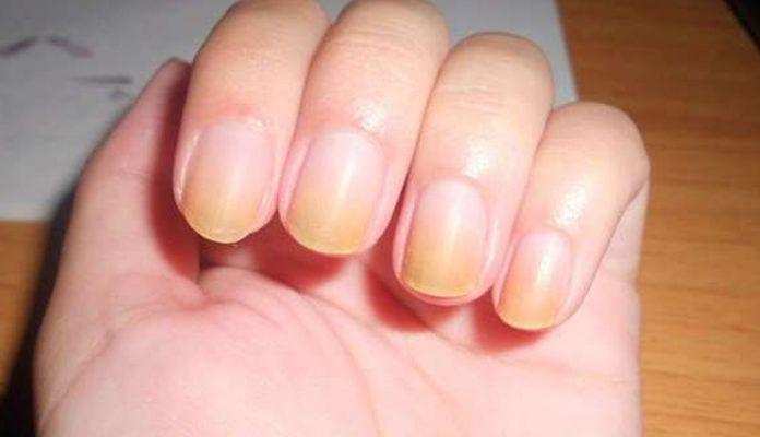 Nail Tips न ख न क प ल पन स छ टक र प न च हत ह त जर र ट र ई कर य ट प स