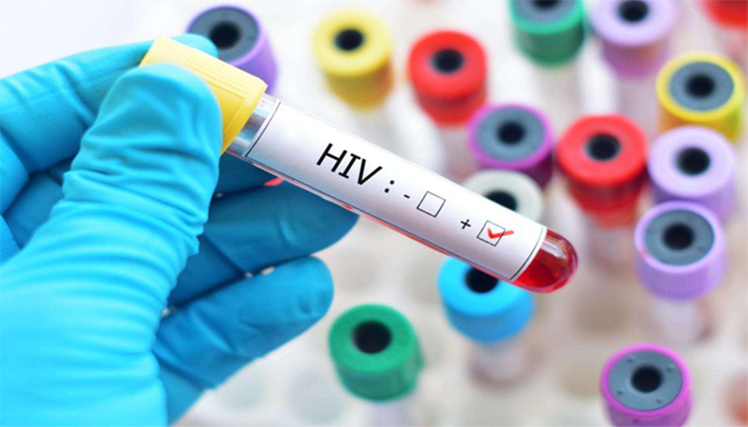 शोधकर्ताओं ने कहा, एचआईवी संक्रमण से दिल के रोग का जोखिम दोगुना