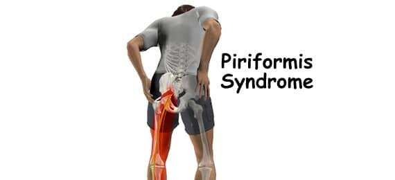 साइटिका बीमारी के कारण, लक्षण और उपचार के बारे में जानकारी