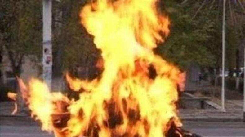 दिवाली पर हो गया है पटाखे चलते समय बर्न तोह ध्यान में रखें ये बात 