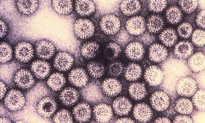 बच्चे की जान भी जा सकती है रोटावायरस से, जानिए इसके लक्षण और बचाव